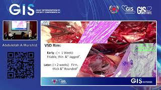 Abdulelah A Murshid - Post MI VSD Closure  A Call for Interventional Expertise