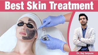 Which Is The Safest & Most Preferable Skin Treatment | No. 1 Skin Laser for Acne Scars & Open Pores