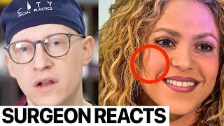 Did Shakira have a Fat Transfer to her Face? Dr. Gary Linkov