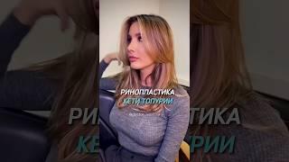 Ринопластика знаменитости #челюстнолицевойхирург  Кэти Топурия