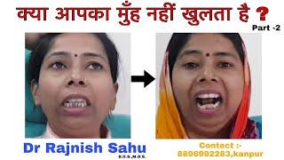 TMJ ANKYLOSIS Before and After || Part-2 @rajnishsahu82