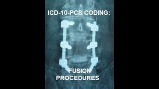 ICD-10-PCS Coding for Fusions