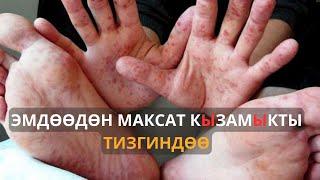 Эмдөөдөн максат кызамыкты тизгиндөө