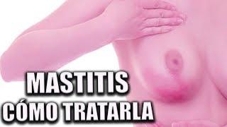 MASTITIS en la lactancia | Cómo tratarla y consejos para ayudar a superarla