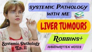 Systemic Pathology- Chapter: Liver Tumours| Robbins + Notes |MBBS 2nd Year |NEET PG |MD DNB | FMGE