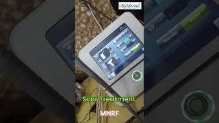 Say Goodbye to Hair Scars! First Time in Durgapur – Advanced Hair Scar Treatment at eEpiderma ‍