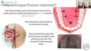 Why is Tongue Posture Important?