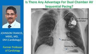 Is There Any Advantage For Dual Chamber AV Sequential Pacing?