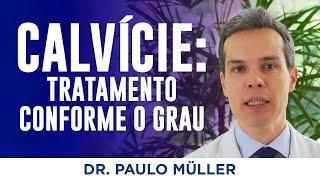 Calvície, Tratamentos Conforme o Grau – Dr. Paulo Müller Dermatologista.