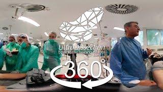 Sciatic nervus´s block (gluteus and subgluteus) Dr. Carlos Salazar | 360º | UltraDissection