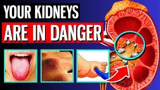 10 ALARMING Signs Your Kidneys Are Crying For Help