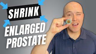 How to shrink enlarged prostate | Benign Prostatic Hyperplasia (BPH)