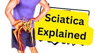 The Sciatica Treatment that ACTUALLY Works