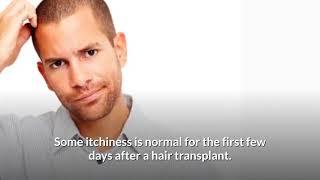 Do’s & Don’ts After Hair Transplant ....