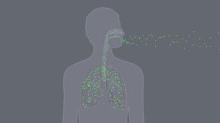 How can you find out if you've been exposed to TCE? - Medical Testing