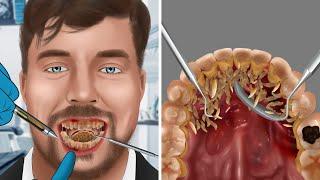 Help MrBeast Be careful with tooth decay and gingivitis | WOW Brain Relax