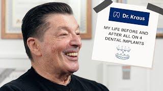 All-on-4 Dental Implants Patient Review: My Self-Confidence is Back! 