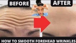  how to get rid of forehead wrinkles,frown lines, middle eyebrow wrinkles antiaging yoga try #yoga