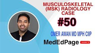 Musculoskeletal (MSK) Radiology CASE #50
