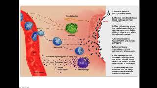 SCI 154   wound classification and stages of wound healing