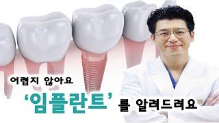 병원가기 전에 꼭 보고가세요!! 치과의사가 알려주는 임플란트의 모든 것!!!