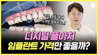 디지털 풀아치 임플란트와 전체 임플란트 비교 가격