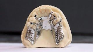 Envision One | Dental Masters Laboratory (part 3)