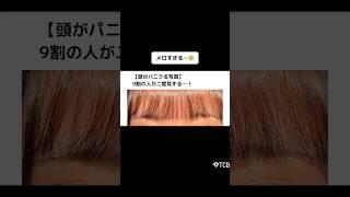 【二重整形】9割の人が二度見する…！ #shorts