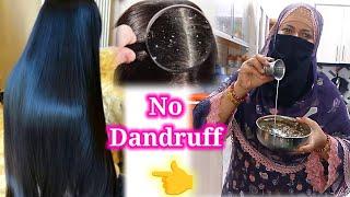No Dandruff remedy | Daily vlogs | BinteSaeed Kitchen and life