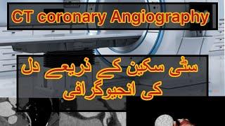 CT coronary Angiography | CT scan k zariay dil ki angiography | Angiography