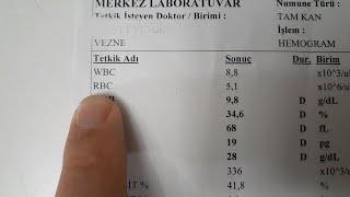 INTERPRETING THE HEMOGRAM (COMPLETE  BLOOD COUNT) RESULT !