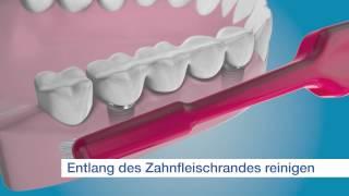 TePe Implantat/Orthodontiebürste - für die Reinigung der Außenflächen des Implantats