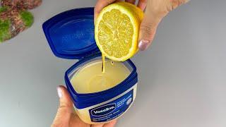 Mix Vaseline with Lemon and you will be shocked! If only I had known about this earlier!