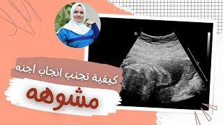 اسباب تشوهات الجنين خلال فتره الحمل وكيف يمكن تفاديها وتجنبها مع الدكتوره هيا حجازي