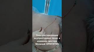 #рефлексотерапия #иглорефлексотерапия #иглоукалывание #иглотерапия #акупунктура #клиникаоригитея