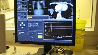 LIVE CT Cardiac on Aquilion ONE