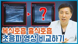 복식호흡 남들 따라하지 말고 스스로 할 수 있는 만큼 일단 한번 해보세요.