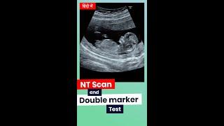 What is NT Scan and Double marker Test(First Trimester of Pregnancy).