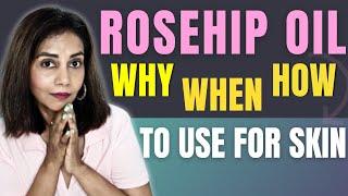 Magic of Rosehip Oil for Your Face: How it HELPS & Tips for Perfect Use!