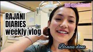 My dentist appointment in south korea   3rd pointman || I’m nervious //rajani diaries 