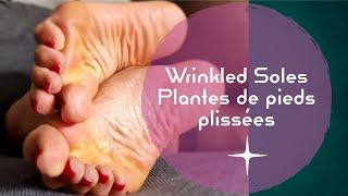 My wrinkled soles - Mes plantes de pieds plissées