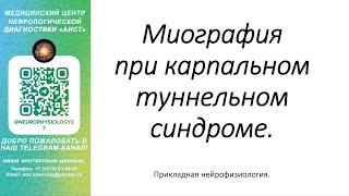 Тема: Миография при карпальном туннельном синдроме.