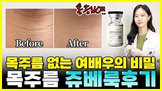 피부나이테 목주름 없애는 방법? 여배우도 했다는 목주름 쥬베룩 후기! 부천쥬베룩, 부천피부과