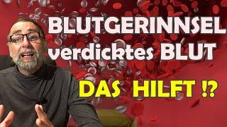 Blutgerinnsel und zu dickes Blut‼ 5 natürliche Alternativen!