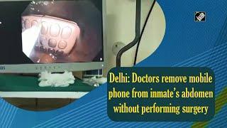 Delhi: Doctors remove mobile phone from inmate’s abdomen without performing surgery