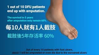 Care for Diabetic Foot