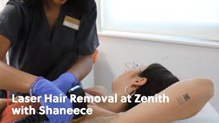 Laser Hair Removal at Zenith with Shaneece