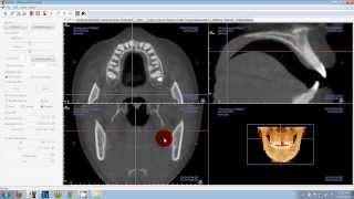 Save Time with Invivo5 / Tx STUDIO DVD - Sample Trailer
