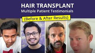 Hair Transplant - Patient Reviews | Medlinks | Before & After Results | Multiple Client Testimonials