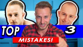 My 3 Worst Hair Loss Mistakes I regret!